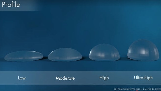 Breast Implant Profile and Pro