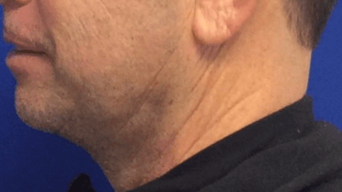 Dr Suzman  Plastic Surgeon