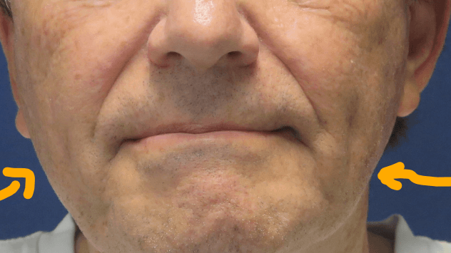 Dr Suzman  Plastic Surgeon
